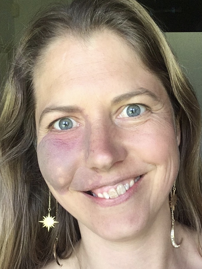 Frances Goodall — Wellness Practitioner & Women's Circle Facilitator